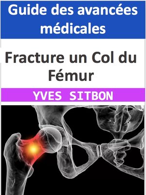 cover image of Fracture un Col du Fémur
